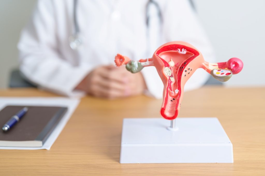 Doctor with Uterus and Ovaries anatomy model
