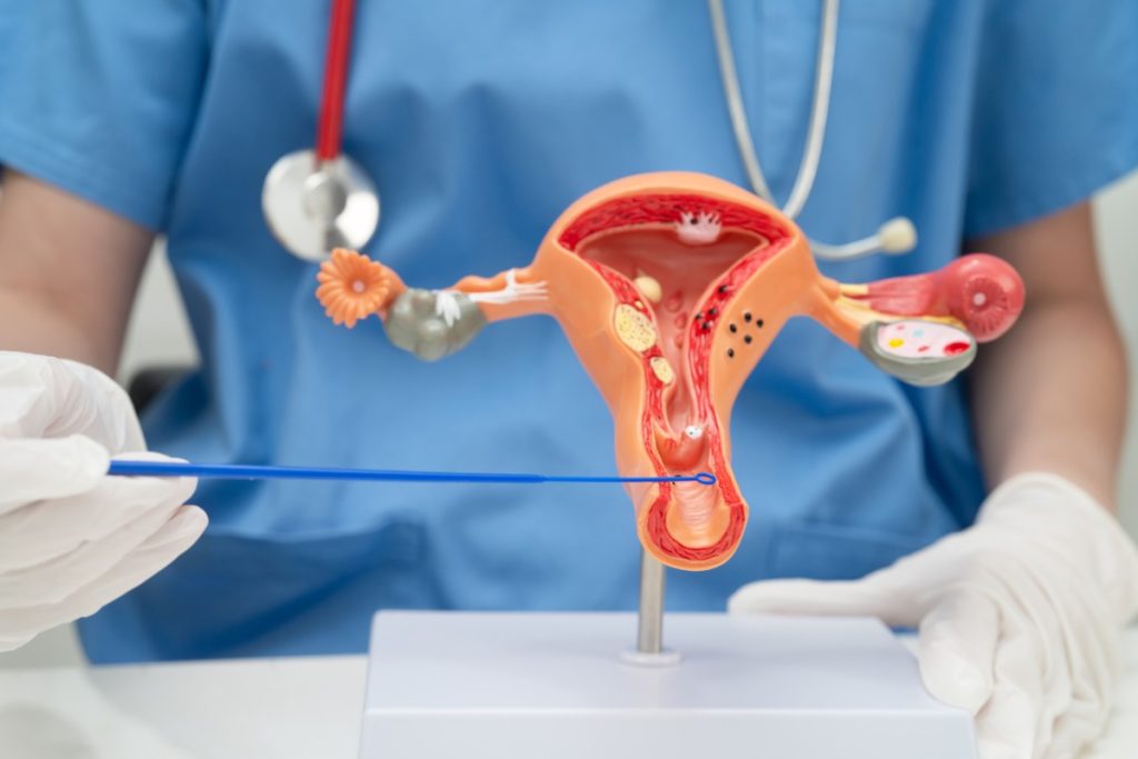 Doctor holding human uterus model for vaginal and cervix pap smear check up
