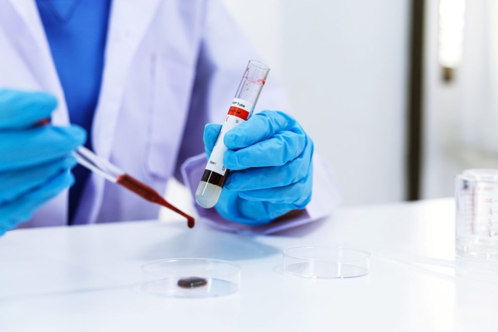 medical professional testing a blood sample