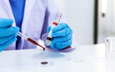What Is Anti-Mullerian Hormone (AMH) Test And Why Is It Done?