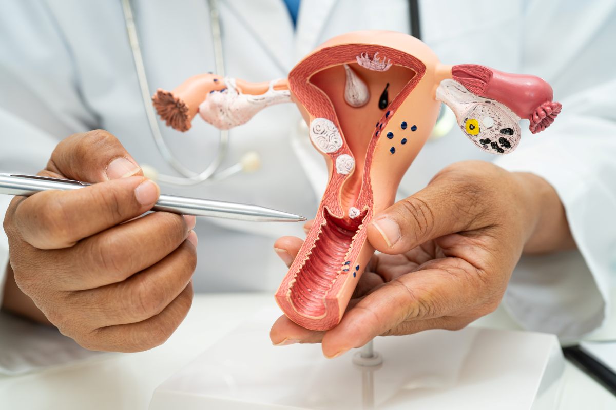 Vaginitis (Vaginal Infections) Types, Causes, Symptoms, Treatments Uterus, doctor with anatomy model for study diagnosis and treatment at hospital