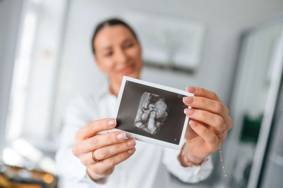 woman wearing white holding ultrasound picture of baby