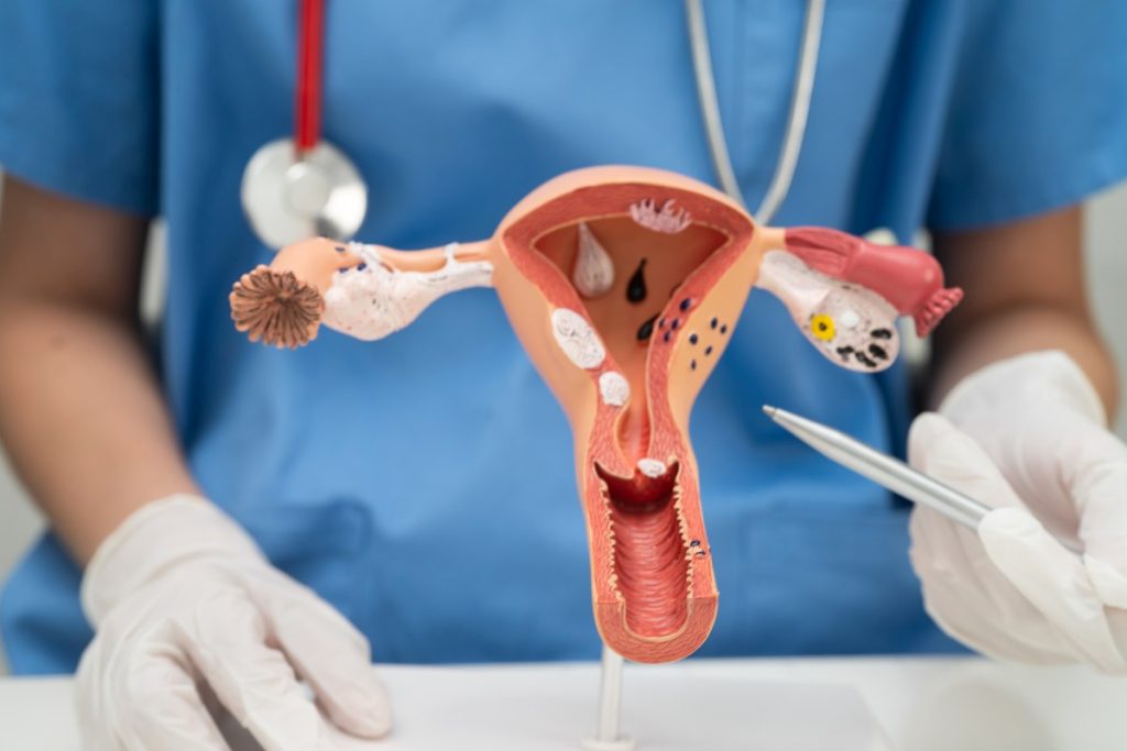 Uterus, doctor holding human anatomy model for study treatment in hospital.