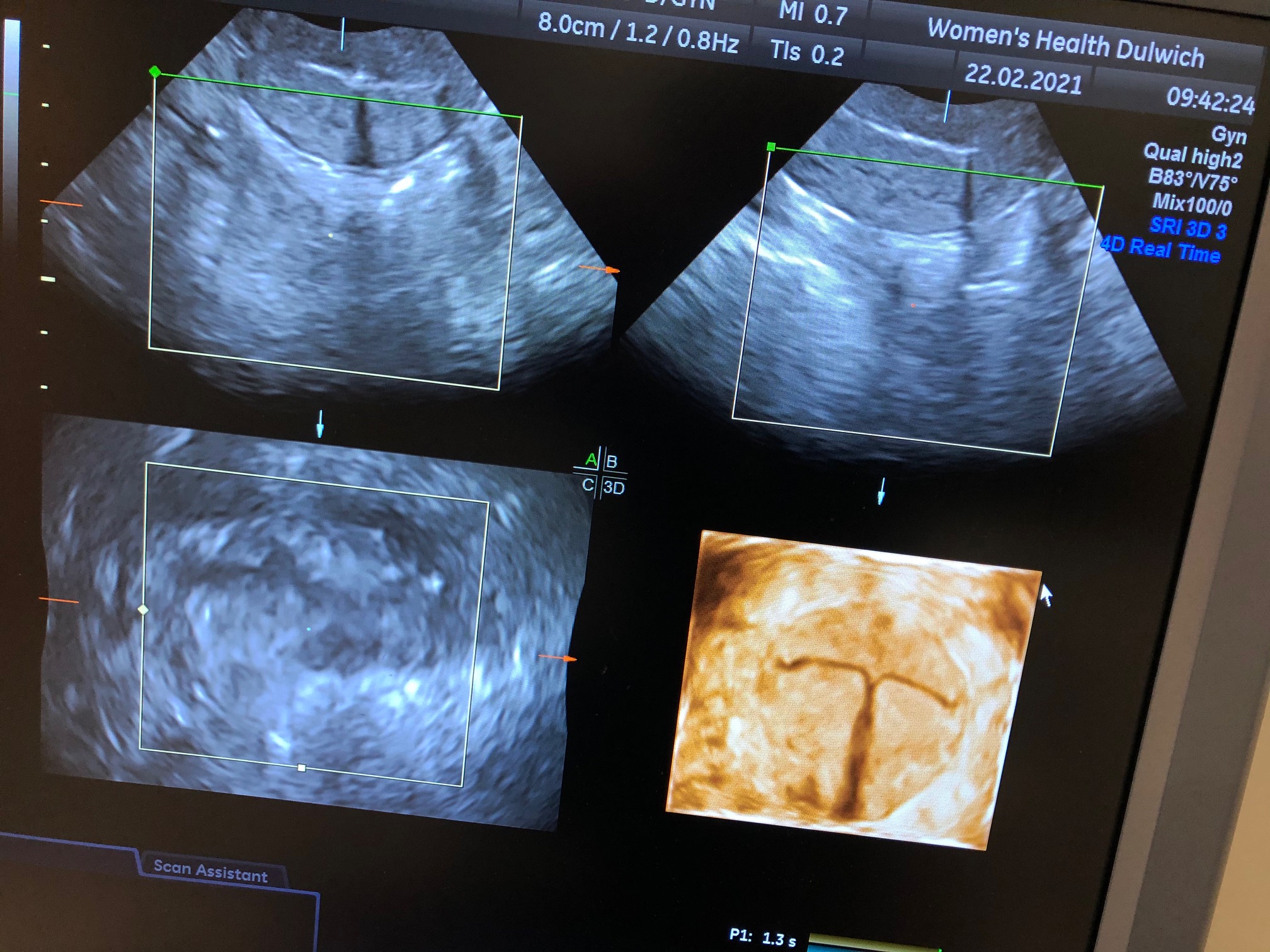 Private Obstetrican in London Image