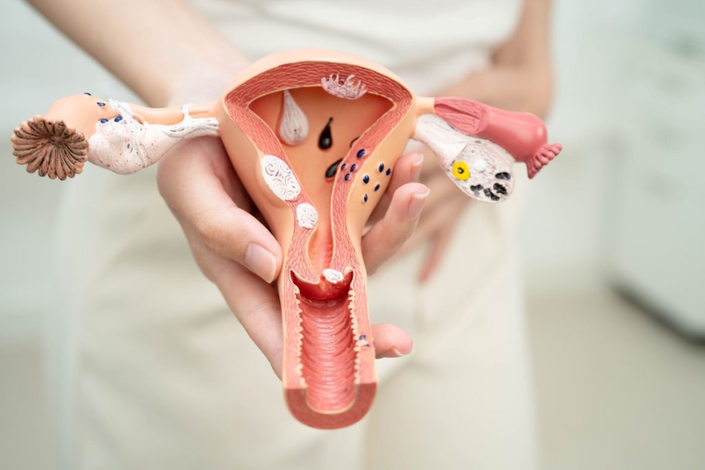 Uterus, Asian, woman holding human