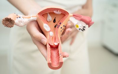 Vaginal Dryness Causes Beyond Menopause
