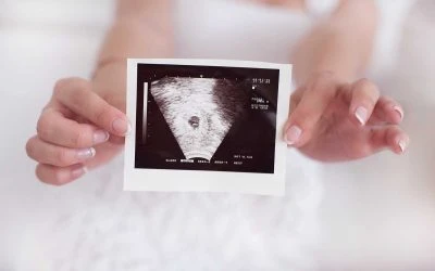 What is an Early Pregnancy / Viability Scan?